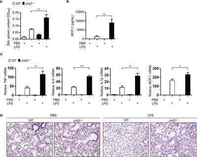 miR-221-5p-Mediated Downregulation of JNK2 Aggravates Acute Lung Injury